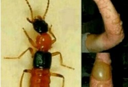 昆虫学家皮肤爆料视频,皮肤爆料视频背后的昆虫奥秘